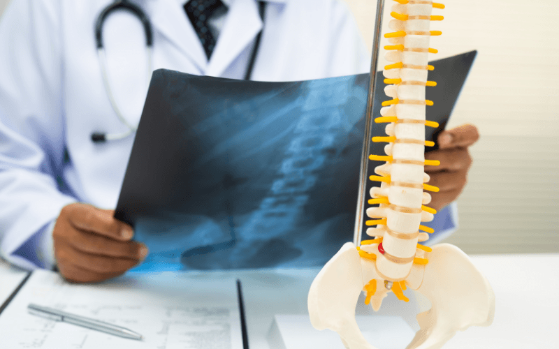 The Difference Between Lumbar Spinal Stenosis and Cervical Spinal Stenosis in DFW